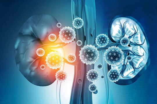 Thận 'kêu cứu' theo 5 giai đoạn