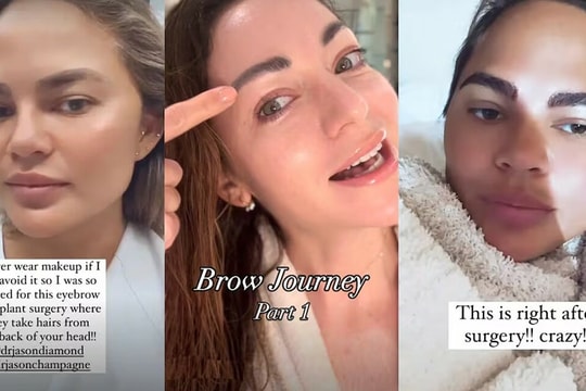 Cơn sốt cấy lông mày giá hàng nghìn USD