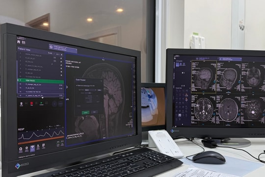 Xơ cứng rải rác - bệnh gây mờ mắt, tê yếu tay chân