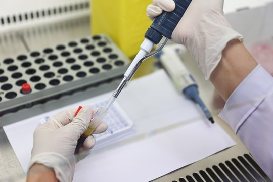 Overthinking - kẻ thù giấu mặt của phong độ đàn ông