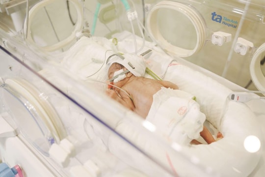 Nuôi sống bé sinh non ngừng thở, bệnh tim bẩm sinh