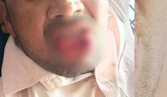 Bị quấy rối trên đường, cô gái đáp trả theo cách khiến kẻ tấn công choáng váng