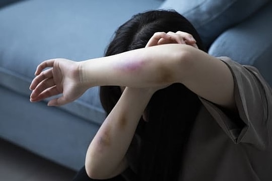 Tranh cãi 'có tội hay không' khi khiến bạn gái tự tử sau cãi vã căng thẳng