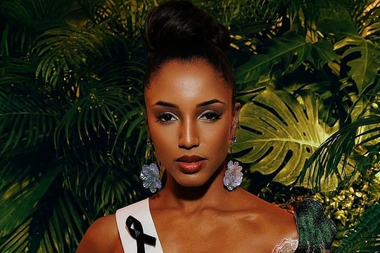 Hoa hậu Jamaica chưa hồi phục sau cú ngã ở Miss Universe