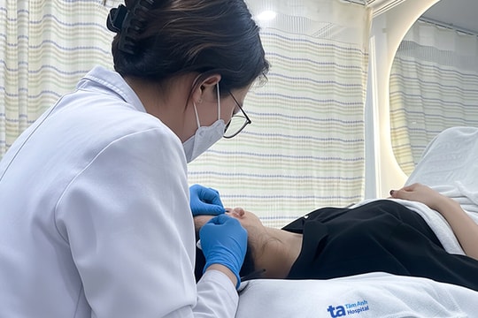 Tai biến dạng sau hai năm lấy sụn nâng mũi