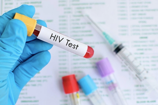 Hình thái lây nhiễm HIV ở Việt Nam thay đổi