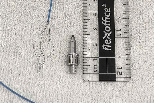 Dụng cụ nha khoa rơi vào đường thở sau khi làm răng