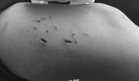 Bé trai 14 tuổi nguy kịch sau khi bị “kẻ tưởng vô hại” trong vườn nhà tấn công