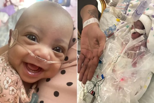 Bé gái nặng bằng lon nước ngọt sống sót sau 153 ngày nuôi lồng kính