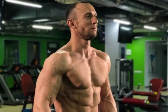 HLV thể hình tử vong vì thử thách tăng cân cực đoan