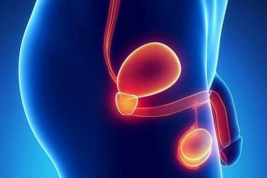 Ung thư tinh hoàn giai đoạn muộn ở tuổi 19