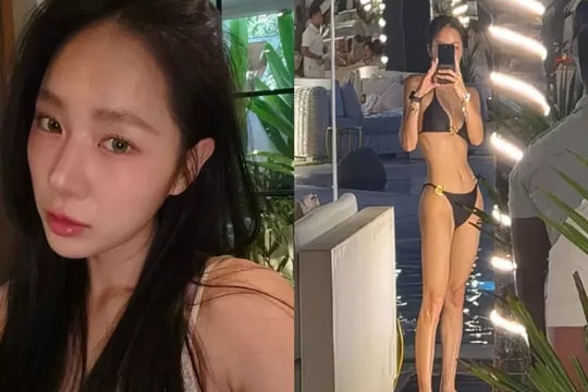 Nữ ca sĩ quá gầy sau khi giảm 10 kg