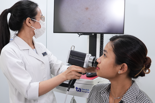 4 sai lầm khiến mụn trứng cá dai dẳng