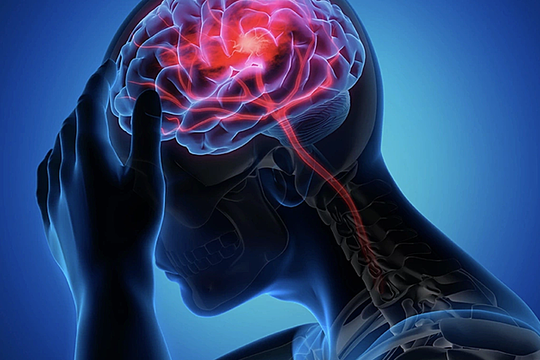 Đột quỵ khi đi vệ sinh lúc 2 giờ sáng