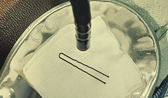 Bé gái 4 tuổi đột ngột khóc thét, vào viện bác sĩ gắp ra thứ "đáng sợ" bên trong