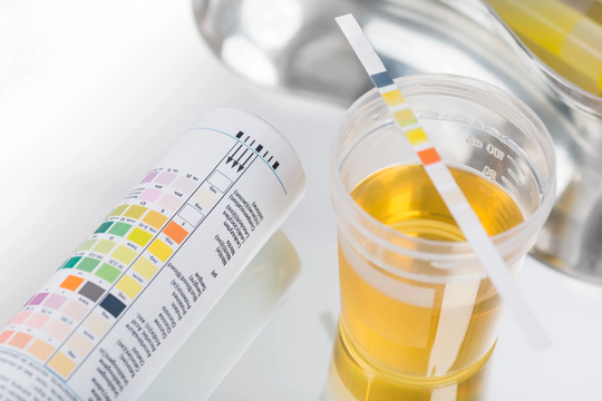 4 xét nghiệm đơn giản giúp phát hiện sớm bệnh thận