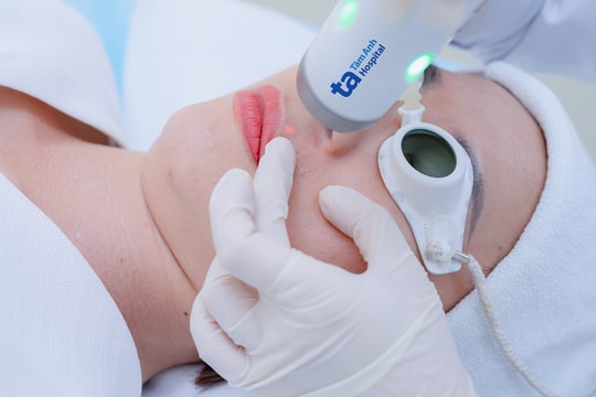 Có thể triệt ria mép bằng phương pháp nào?