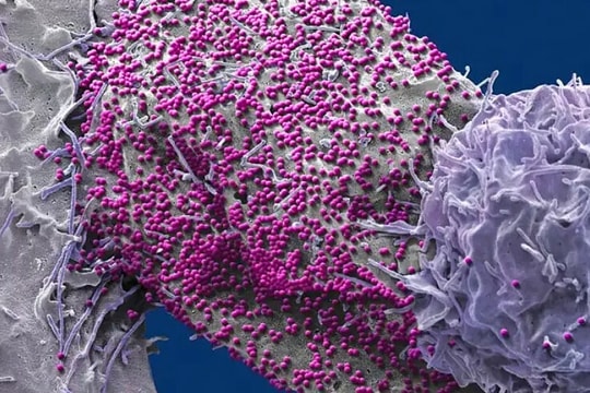 Bất ngờ khỏi HIV sau khi ghép tế bào gốc