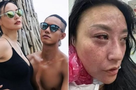 Diễn viên Tâm Vân bị chồng kém 16 tuổi bạo hành