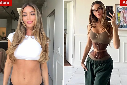 Những cô gái cắt xương sườn tìm 'eo con kiến'