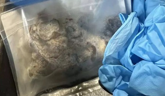 Nam 17 tuổi nguy kịch, phải cắt một phần phổi vì thói quen "gây nghiện" của giới trẻ