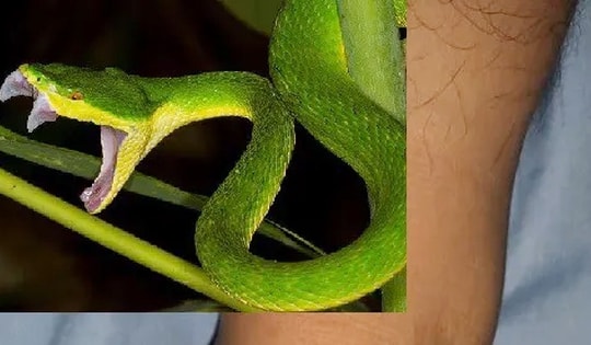 Bị rắn cắn, người đàn ông nguy kịch do tự đắp thuốc để "hút độc"