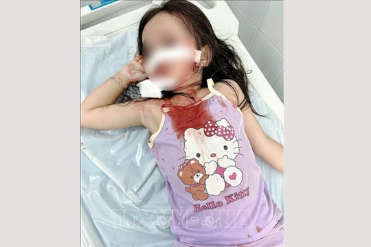 Bé gái 4 tuổi bị chó thả rông tấn công, thương tích nghiêm trọng vùng mặt