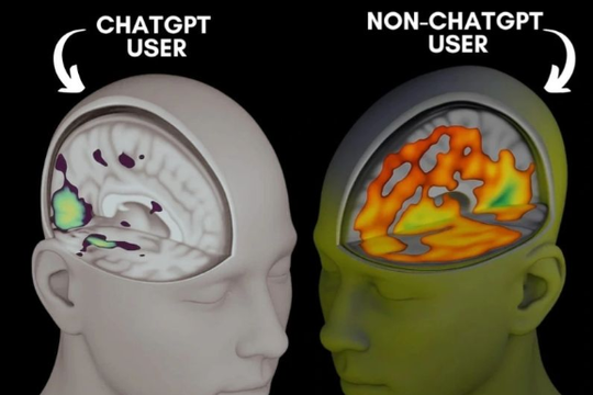Cảnh báo tình trạng suy giảm nhận thức do lạm dụng trí tuệ nhân tạo