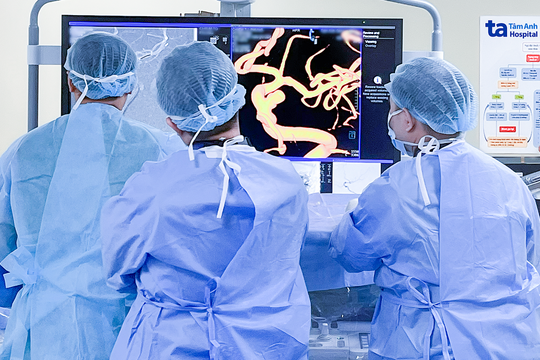 Can thiệp túi phình mạch máu cho người bệnh u não