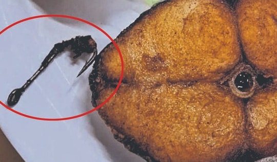 Đang ăn cá chiên, người phụ nữ phát hiện ra thứ đáng sợ