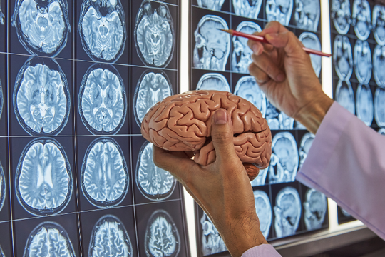 Bác sĩ thần kinh tiết lộ 5 thói quen giúp lấy lại sức khỏe não bộ