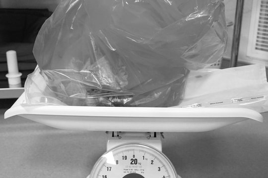 U tử cung nặng 4 kg khiến bụng to như mang thai 9 tháng