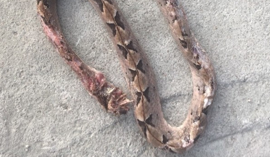 Người đàn ông 27 tuổi suýt mất mạng vì tự ý chữa bệnh theo “kiểu lạ đời"