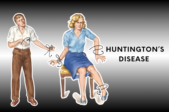 Bệnh Huntington: Căn bệnh khiến con người múa giật không kiểm soát