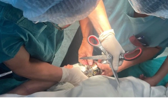 Bé trai 5 tuổi "ôm" ổ khóa nhập viện cấp cứu, bác sĩ phát cảnh báo khẩn