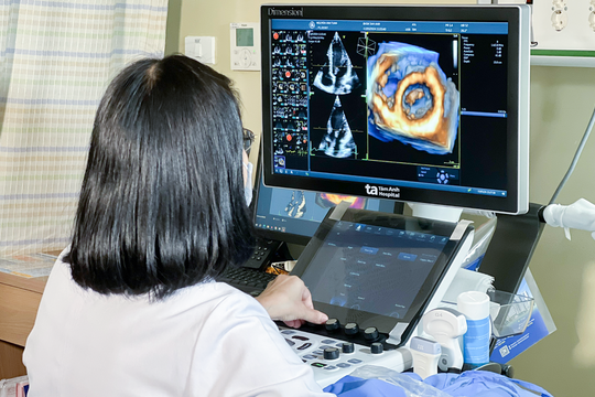 Khó thở hơn hai tuần mới biết nhồi máu cơ tim