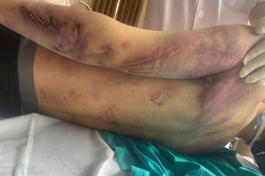 Thiếu niên tử vong sau một ngày vào trung tâm công tác xã hội