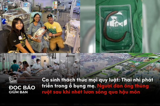 Ca sinh thách thức mọi quy luật: Thai nhi phát triển trong ổ bụng mẹ. Người đàn ông thủng ruột sau khi nhét lươn sống qua hậu môn