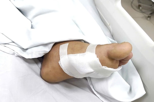 Vết xước nhỏ khiến người đàn ông nguy kịch