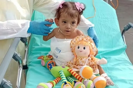 Bé song sinh dính liền qua đời sau 7 tháng nỗ lực tách rời