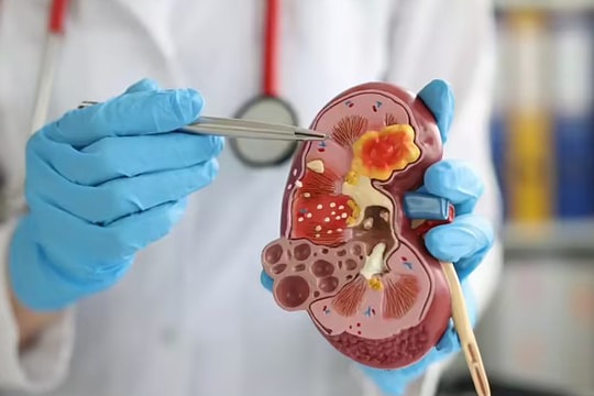 3 lý do khiến thận dễ suy kiệt vào mùa lạnh