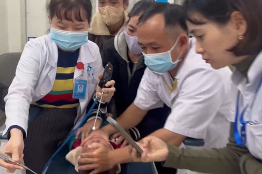 Gắp con vắt ký sinh một tuần trong mũi bé trai 2,5 tuổi