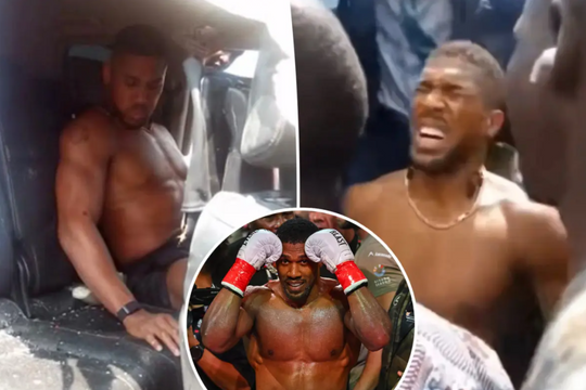 Anthony Joshua thoát chết trong vụ tai nạn xe hơi