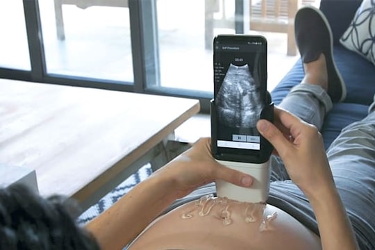 Đột phá mới: Thiết bị cầm tay giúp mẹ bầu tự siêu âm tại nhà