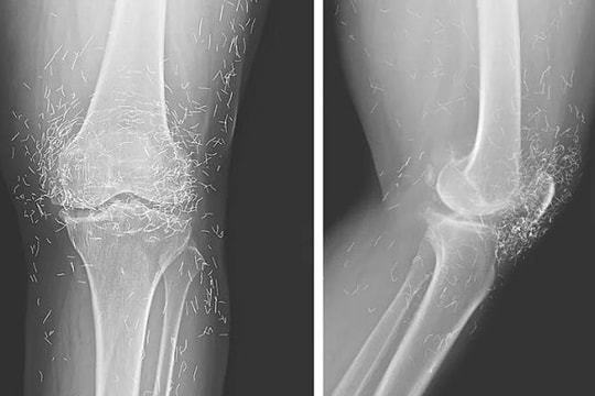 10 ca bệnh 'thách thức chẩn đoán' y khoa thế giới