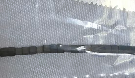 Bé trai hơn 2 tuổi "bụng cứng như đá", bác sĩ phát hiện bí mật "đáng sợ"