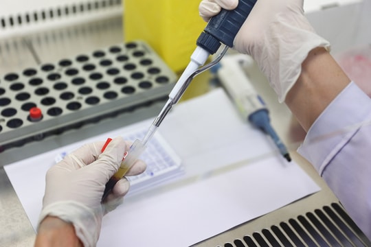 Nhóm 15-29 tuổi chiếm gần nửa số ca HIV mới tại TP HCM