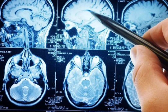 Ngã quỵ khi đang khám bệnh, người đàn ông được cứu sống trong 'giờ vàng'