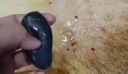 Nuốt mật cá sống để chữa đau đầu, người phụ nữ nhận kết đắng