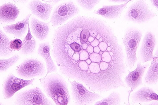 Hiểu đúng về vaccine HPV qua 5 thắc mắc thường gặp